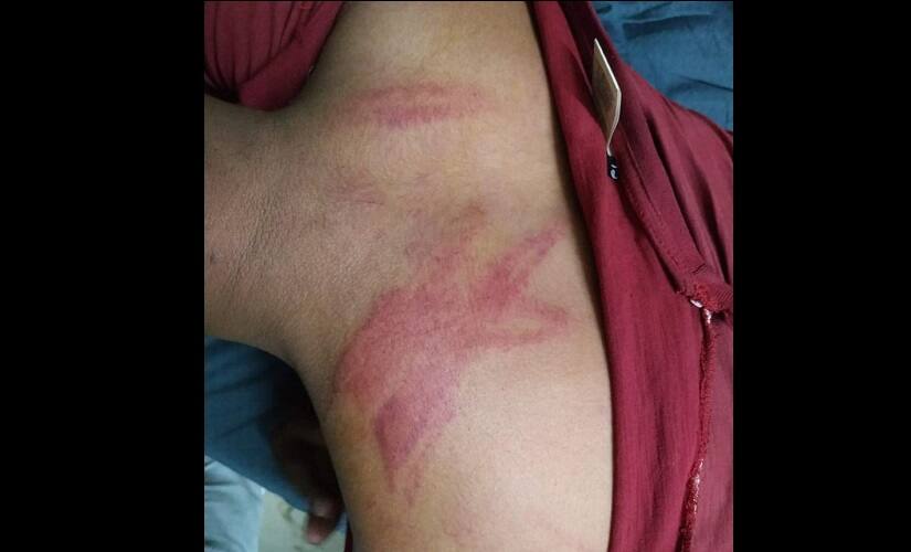 Samer Ullah was beaten up by four men in Kurawar town of Rajgarh district in Madhya Pradesh. 101Reporters
