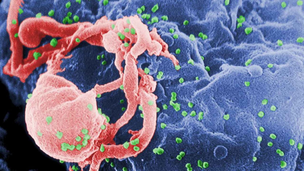 People have a higher chance of contracting HIV in developed, urbanized districts