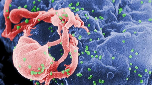 People have a higher chance of contracting HIV in developed, urbanized districts