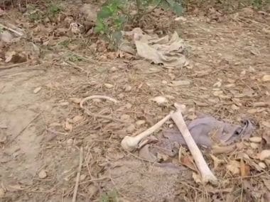 Bihar: Human skeletons found lying near Muzaffarpurs SKMCH hospital, where 108 people died of Encephalitis