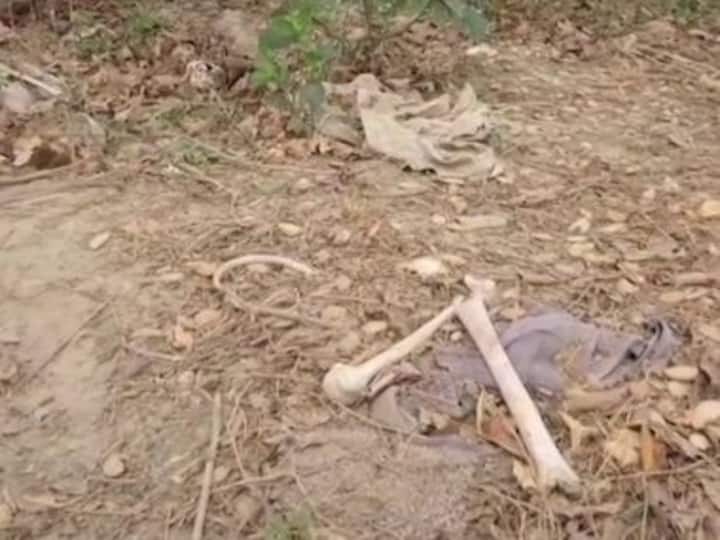 Bihar: Human skeletons found lying near Muzaffarpur's SKMCH hospital, where 108 people died of Encephalitis