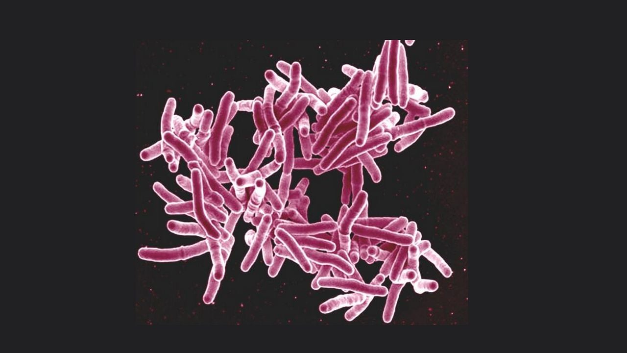 Can Dormant Tuberculosis Become Active