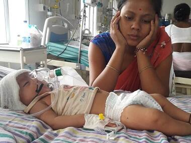 Encephalitis toll in Assam reaches 120 this year; state minister announces free treatment in govt hospitals