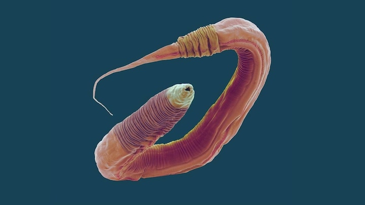 Scientists succeed in mapping every neuron in a worm, a breakthrough in neuroscience