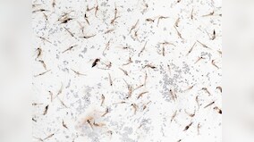 Delhi reported 83 cases of malaria and 34 of dengue this year; mosquito-breeding reported in 48,039 households