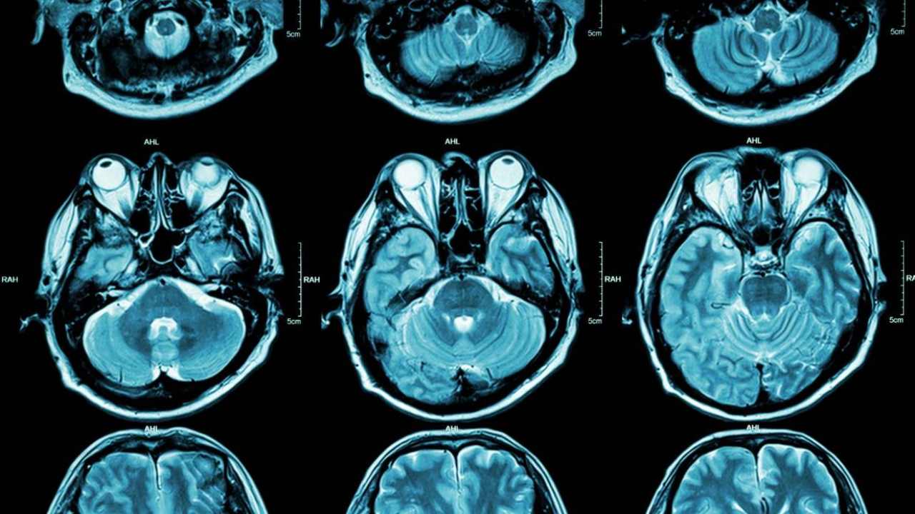 Specific genes influence depression to an extent of PTSD, bipolar disorder, schizophrenia: Study Specific genes influence depression to an extent of PTSD, bipolar disorder, schizophrenia: Study