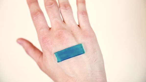Bandage for fast healing inspired by fetal skin developed by Harvard, McGill scientists