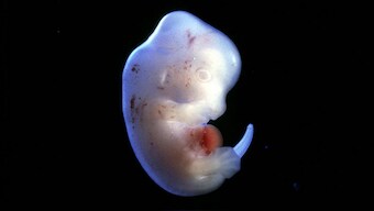 Japanese scientist gets approval to create human-animal hybrids for organ harvesting study