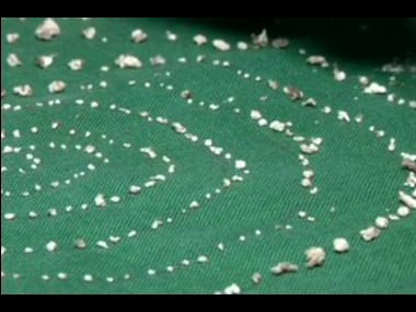 Doctors extract 526 teeth from a 7-year-old boy in Chennai. Image credit: Twitter/@ANI
