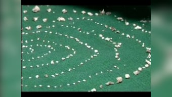 Doctors extract 526 teeth from 7-year-old boy's lower jaw in Tamil Nadu; surgeons claim it's first such case in the world