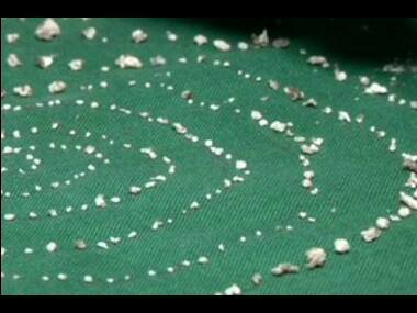 Doctors extract 526 teeth from 7-year-old boy's lower jaw in Tamil Nadu; surgeons claim it's first such case in the world