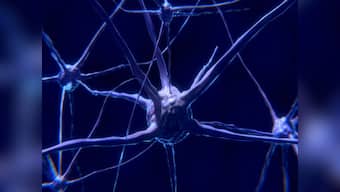 A glitch in the brain: understanding multiple sclerosis