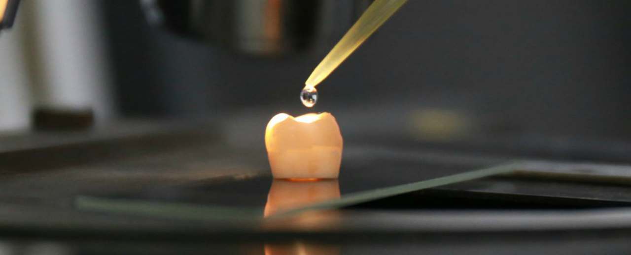 The gel-like substance used to repair tooth enamel. Image credit: Zhejiang University