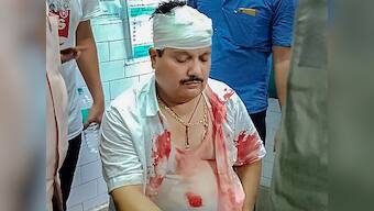 BJP MP Arjun Singh suffers head injuries after police 'baton charge' protesters in West Bengal's Kankinara; authorities deny charge