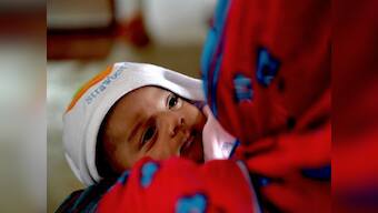 Research: Caesarean babies are born with fewer friendly bacteria