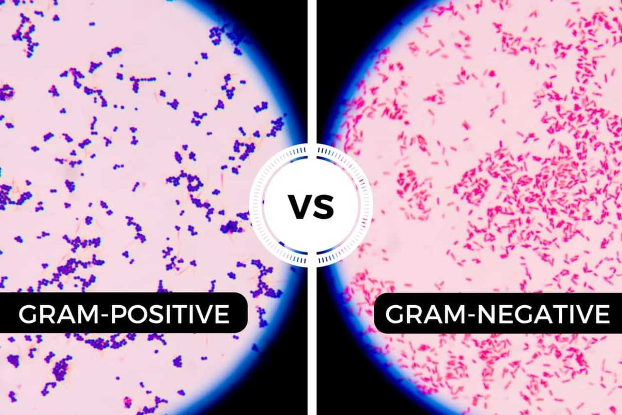 gram positive vs gram negative cluster