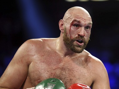 Bloodied in battle with Otto Wallin but unbowed, Tyson Fury says he is 'ready for war' against Deontay Wilder Bloodied in battle with Otto Wallin but unbowed, Tyson Fury says he is 'ready for war' against Deontay Wilder