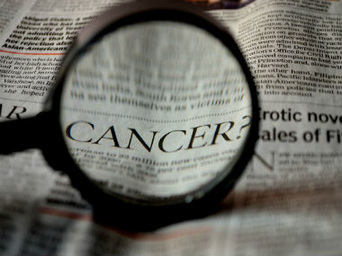 New T-cell findings may lead to a universal cure for cancer New T-cell findings may lead to a universal cure for cancer