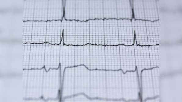 Five subtle signs that you may be at risk of heart disease