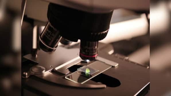 Scientists find the master switch that turns on inflammation: This may help them find a way to manage chronic lung infections in future