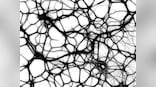 What is excitotoxicity, and what does it have to do with Huntington's disease?