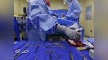 Researchers find a way to super-cool donor livers; their solution may save millions of lives