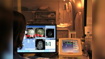 World Stroke Day 2019: What causes a stroke and how can it be prevented