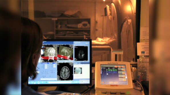 World Stroke Day 2019: What causes a stroke and how can it be prevented