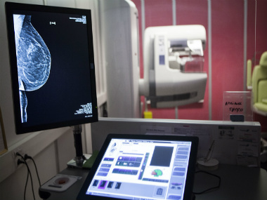 Breast Cancer Awareness Month: 12 different types of breast cancer - Part 2 Breast Cancer Awareness Month: 12 different types of breast cancer - Part 2