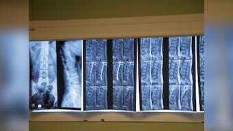 World Spine Day 2019: Everything you need to know about slipped disc, plus three exercises to strengthen the back