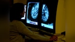 Breast Cancer Awareness Month: 12 different types of breast cancer - Part 3