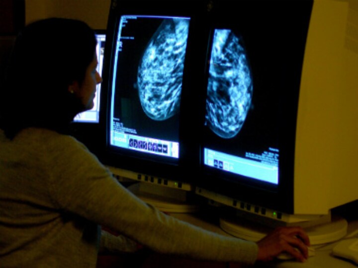 Breast Cancer Awareness Month: 12 different types of breast cancer - Part 3