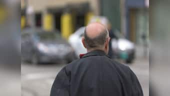 The fix for stretch marks and male pattern baldness might be in our blood, says research