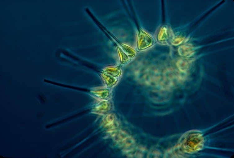 Phytoplankton - the microscopic foundation of the marine food chain. image credit: NOAA/Unsplash, CC BY-SA