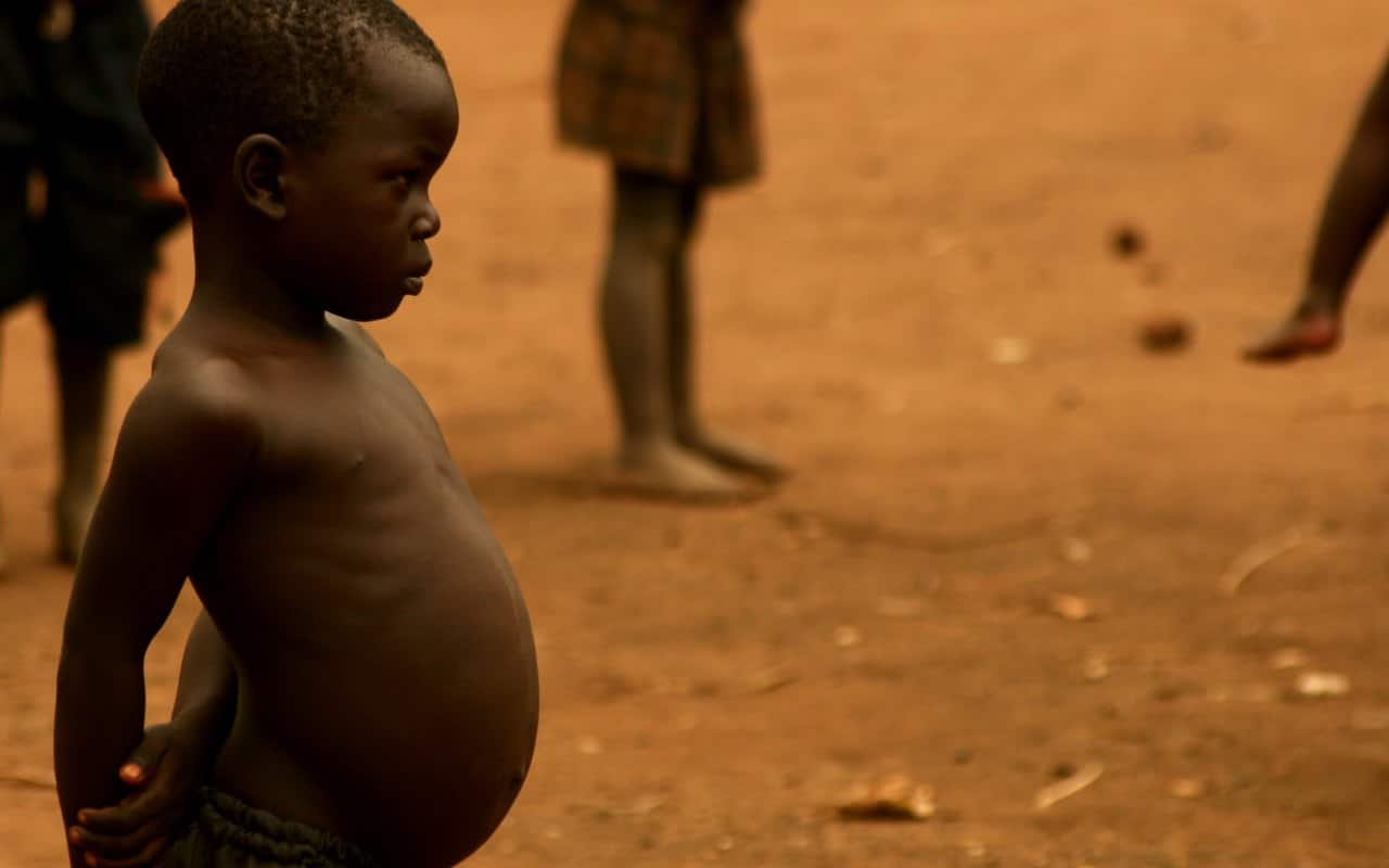 There is severe wasting among children under five is a big concern. Image credit: Flickr/TKnox