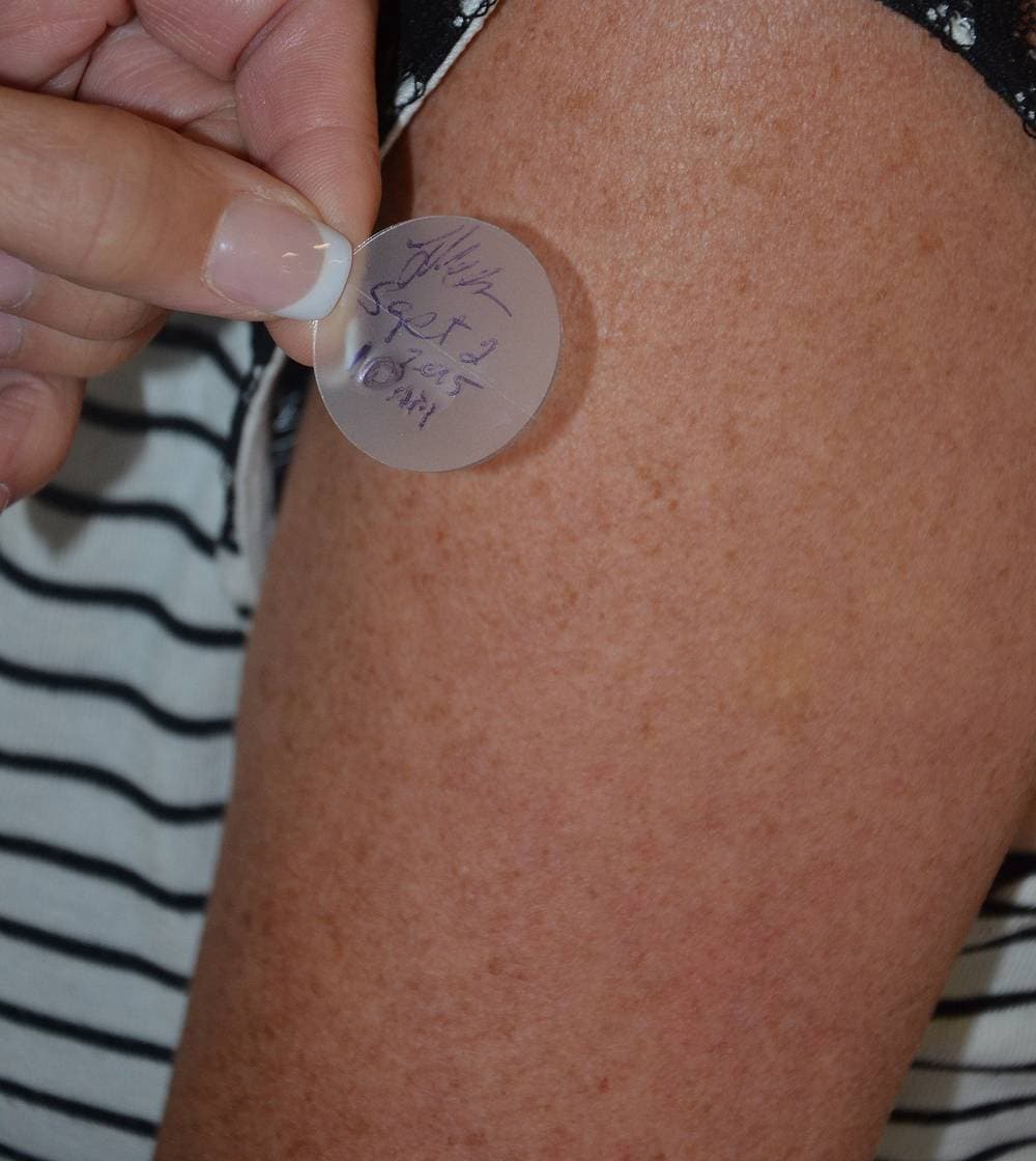A transdermal patch that delivers the medication is applied to the skin. Image credit: Wikipedia/British Columbia Institute of Technology