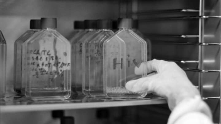 First HIV strain discovered in 20 years is a rare variant of the most common form of the virus