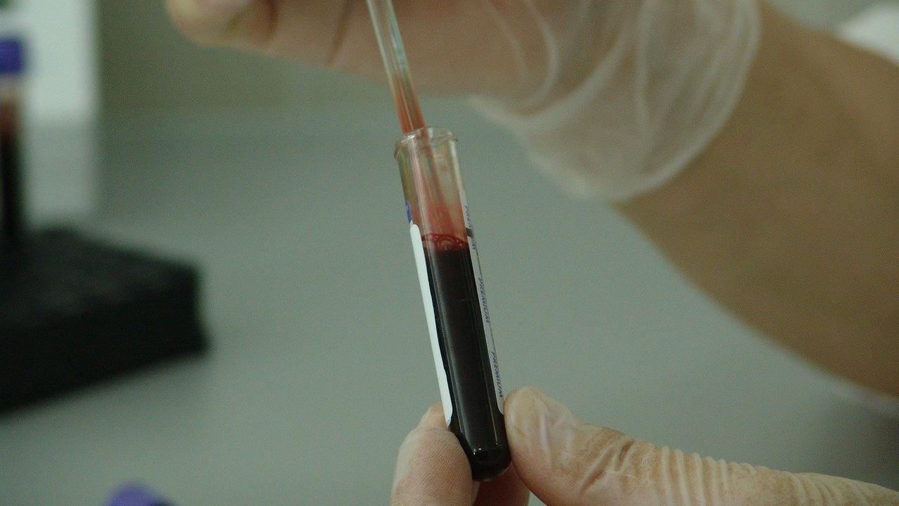 A new variant of the HIV virus was discovered in three blood samples in late 2019.