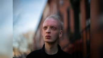 This life-threatening disease has all the signs we've come to associate with vampires