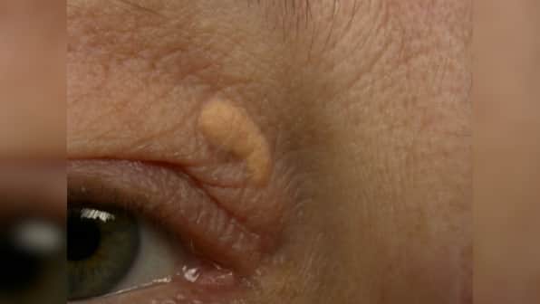Puffy face, itchy ears and 7 other signs of ill health that show on your face