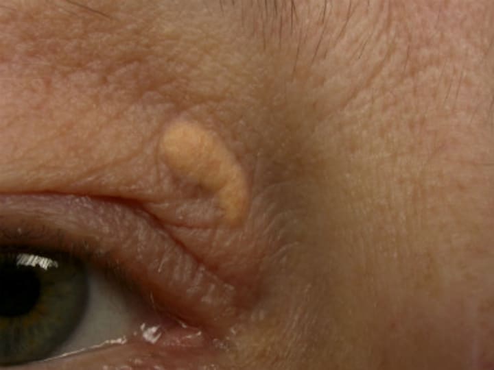 Puffy face, itchy ears and 7 other signs of ill health that show on your face