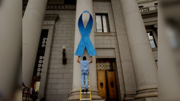 There might be a new home urine test for prostate cancer soon