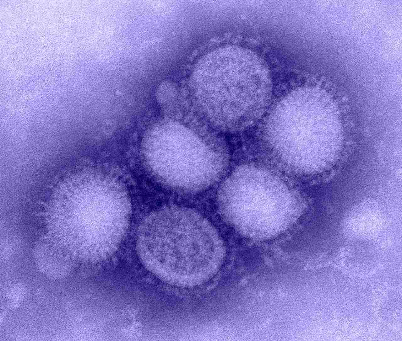 An electron microscope image of the H1N1 influenza virus, taken at the CDC's Influenza Laboratory. Each virus is a mere 80–120 nanometres in diameter. Image: CDC/Wikimedia Commons