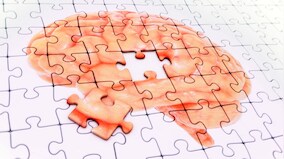 New drug discovered that helps treat delusions in patients suffering from dementia