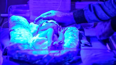 Air pollution causes infertility as well as birth complications, emerging research goes to show