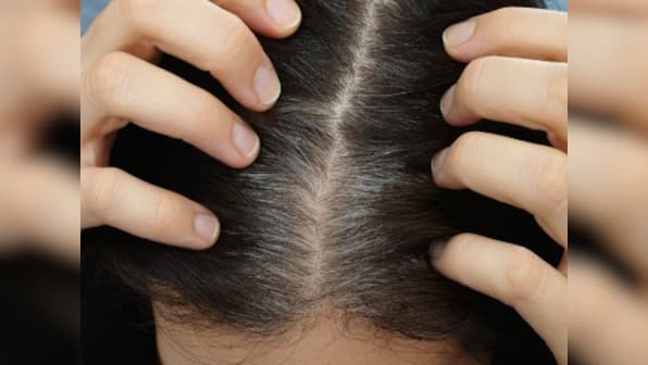 How stress causes grey hair and what to do about it
