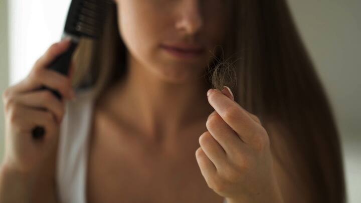 Lots of hair fall in your 20s could be linked to stress, diets, painkillers and more Lots of hair fall in your 20s could be linked to stress, diets, painkillers and more