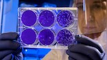 Indian school teacher is the first foreigner to be infected with Coronavirus in China