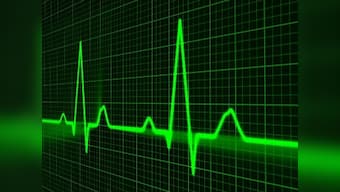 Breath-hold technique could help develop a better treatment for cardiac arrhythmia