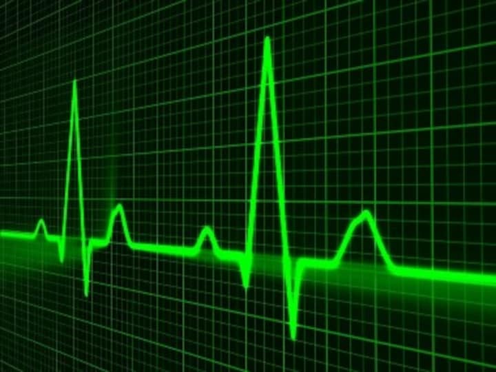 Resting heart rate: What is normal and should you measure yours?